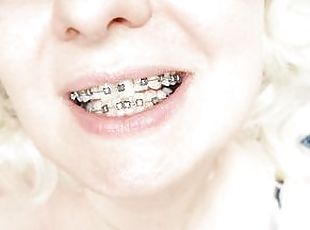 braces fetish: close up video mukbang ..
